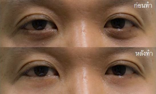 Bi Clinic - Bi Clinic