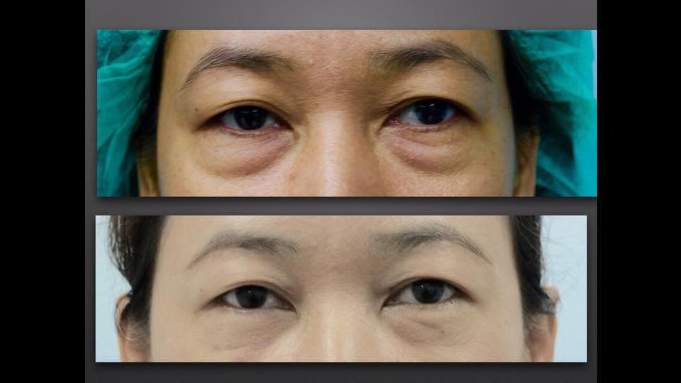 Bi Clinic - Bi Clinic