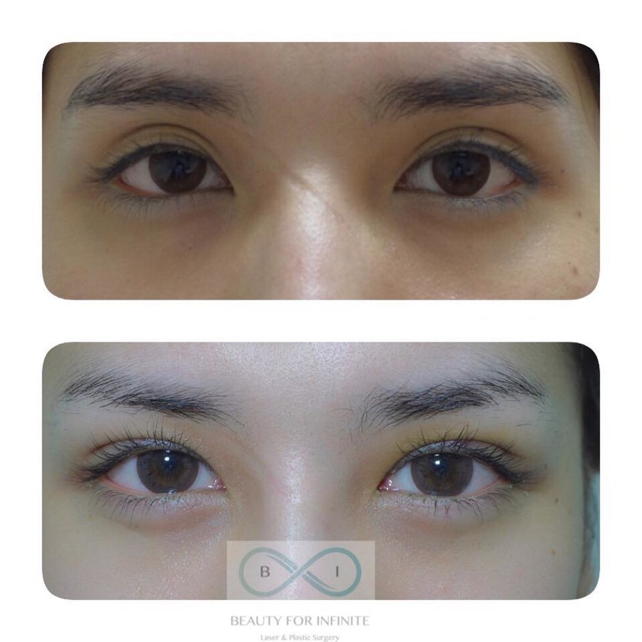 Bi Clinic - Bi Clinic