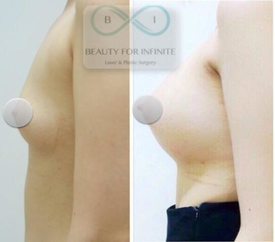 Bi Clinic - Bi Clinic