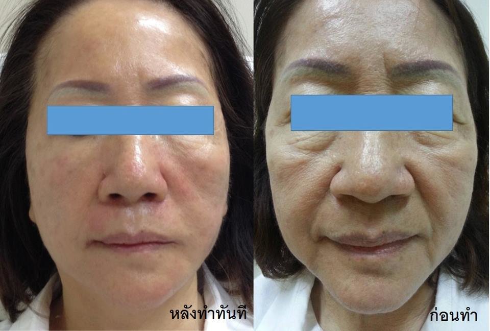 Bi Clinic - Bi Clinic