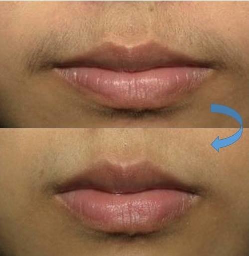 Bi Clinic - Bi Clinic