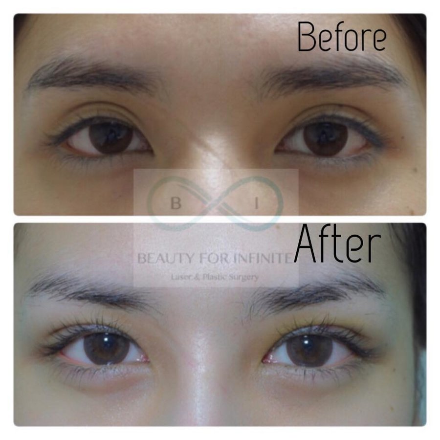 Bi Clinic - Bi Clinic