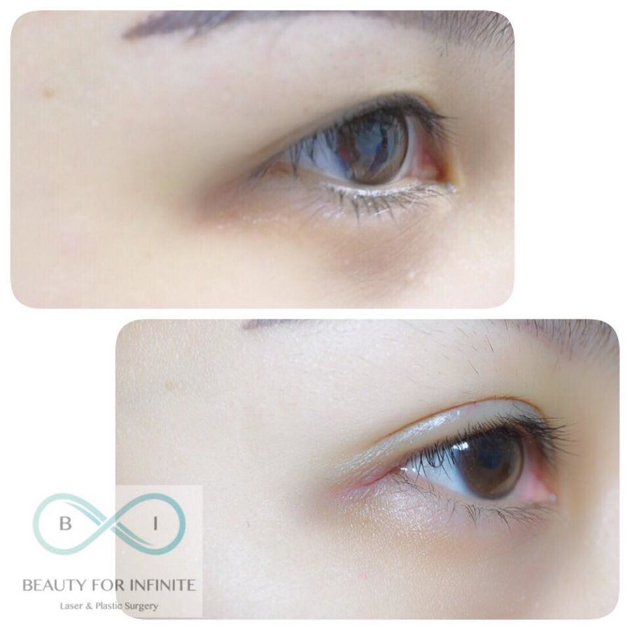 Bi Clinic - Bi Clinic