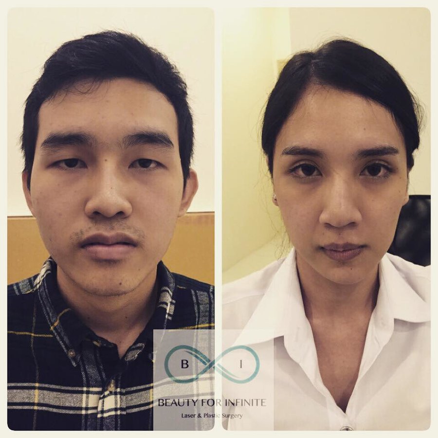 Bi Clinic - Bi Clinic