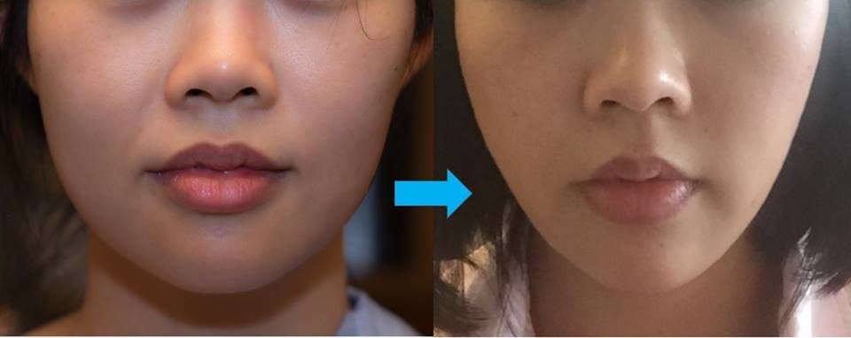 Bi Clinic - Bi Clinic