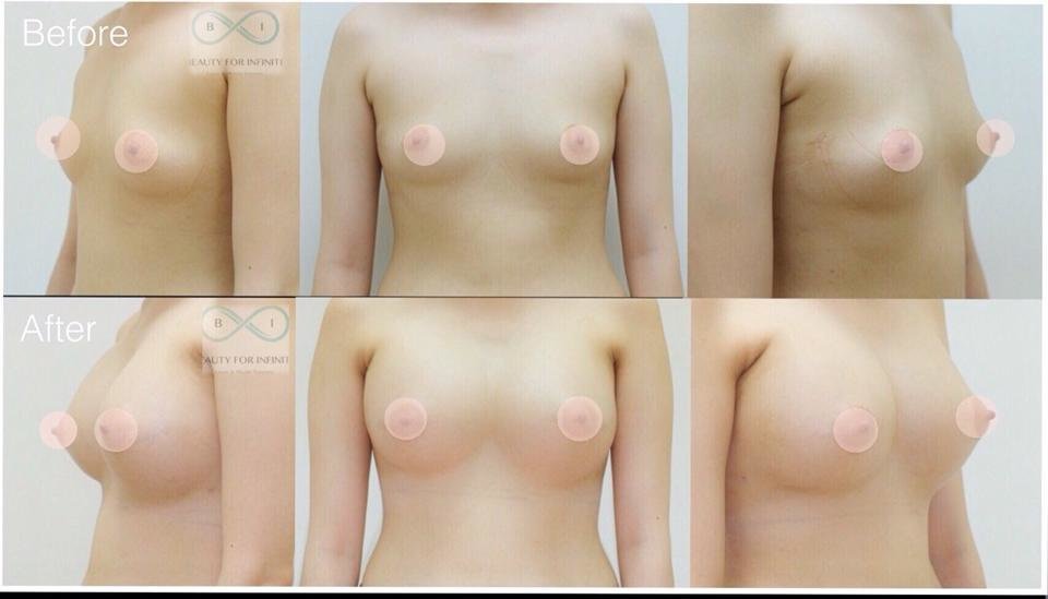 Bi Clinic - Bi Clinic