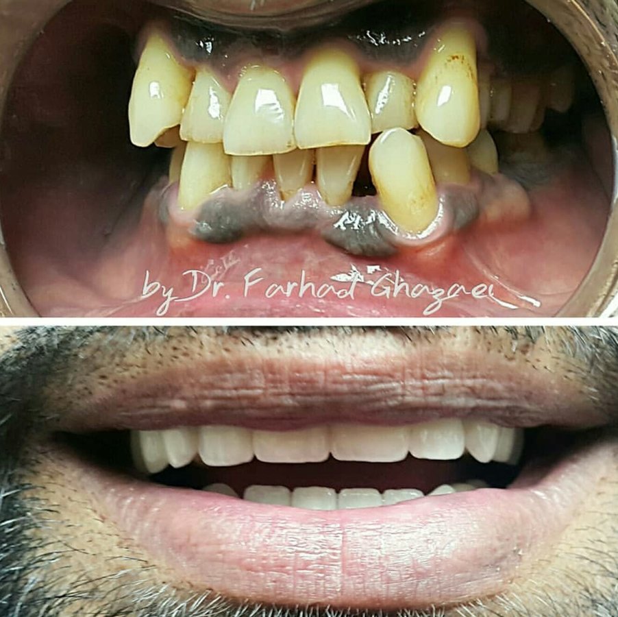 BioDent Esthetic Dentistry - BioDent Esthetic Dentistry