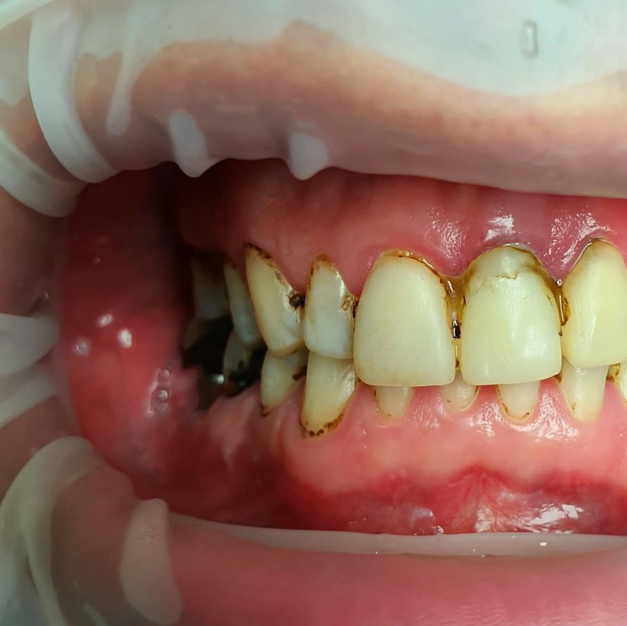 BioDent Esthetic Dentistry - BioDent Esthetic Dentistry