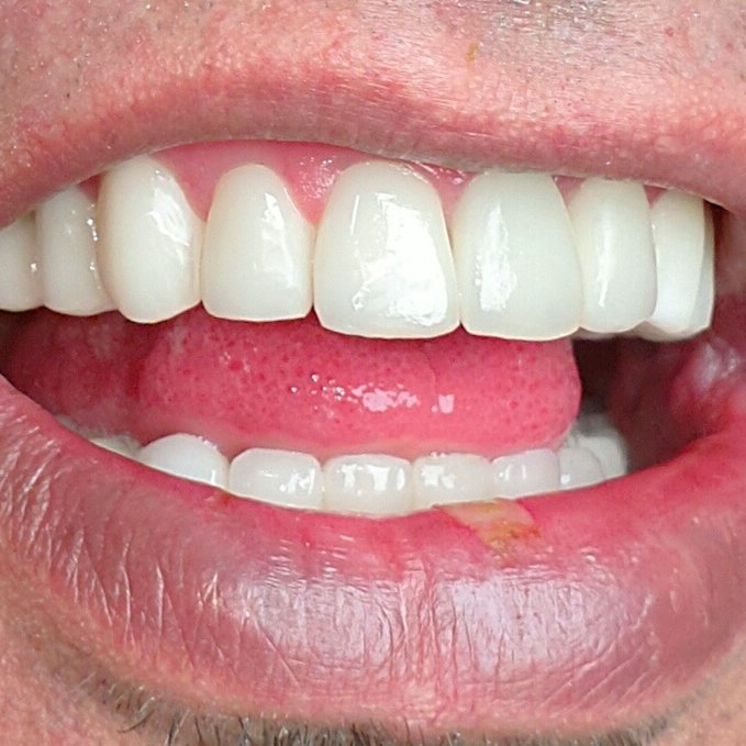BioDent Esthetic Dentistry - BioDent Esthetic Dentistry