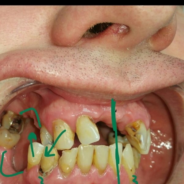 BioDent Esthetic Dentistry - BioDent Esthetic Dentistry