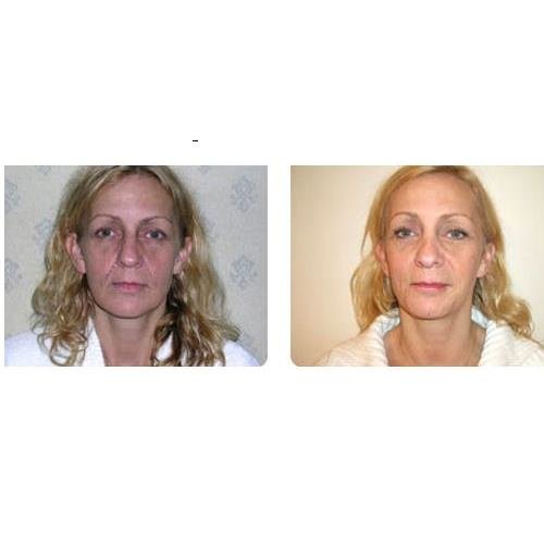 برمنغهام بيوتي كلينيك - برمنغهام - Birmingham Beauty Clinic - Birmingham
