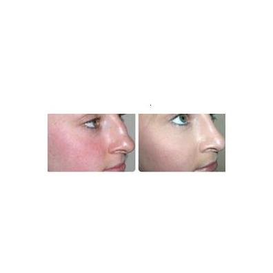 برمنغهام بيوتي كلينيك - برمنغهام - Birmingham Beauty Clinic - Birmingham