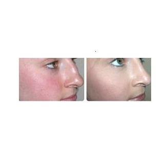 Birmingham Beauty Clinic - Cheltenham - Birmingham Beauty Clinic - Cheltenham