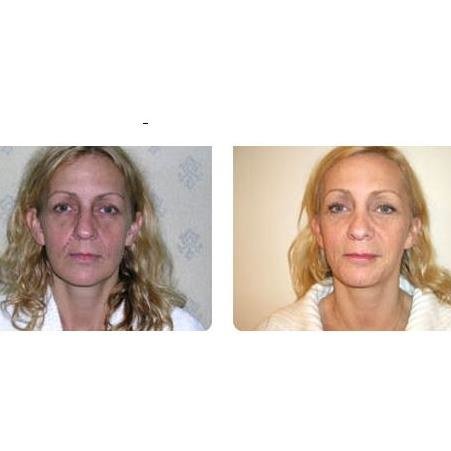 Birmingham Beauty Clinic - Edgbaston - Birmingham Beauty Clinic - Edgbaston