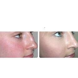 Birmingham Beauty Clinic - Edgbaston - Birmingham Beauty Clinic - Edgbaston