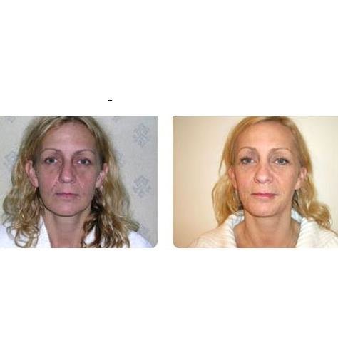 Birmingham Beauty Clinic - Sutton Coldfield - Birmingham Beauty Clinic - Sutton Coldfield