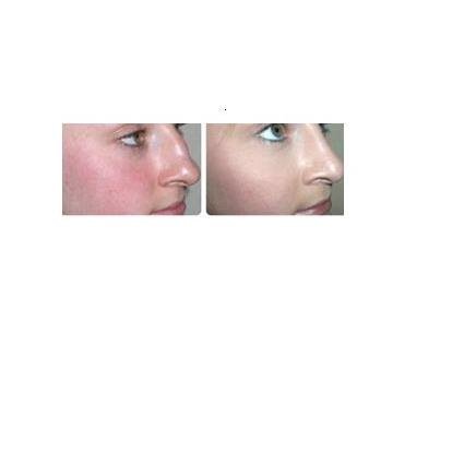 Birmingham Beauty Clinic - Sutton Coldfield - Birmingham Beauty Clinic - Sutton Coldfield