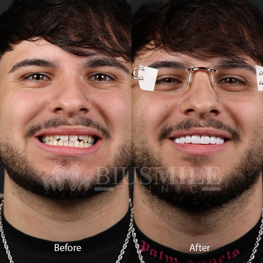 عيادة الابتسامة بيو - Biu smile clinic