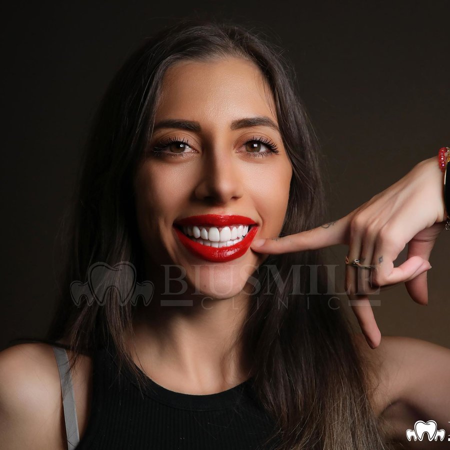 عيادة الابتسامة بيو - Biu smile clinic