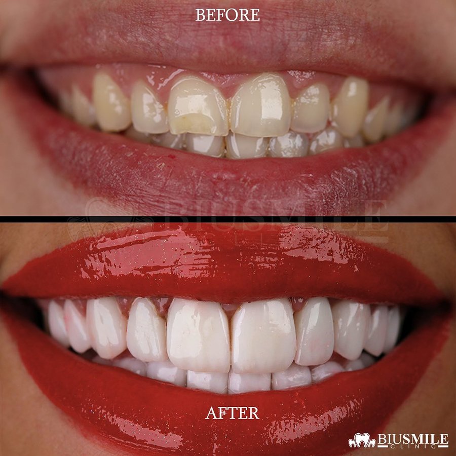 عيادة الابتسامة بيو - Biu smile clinic