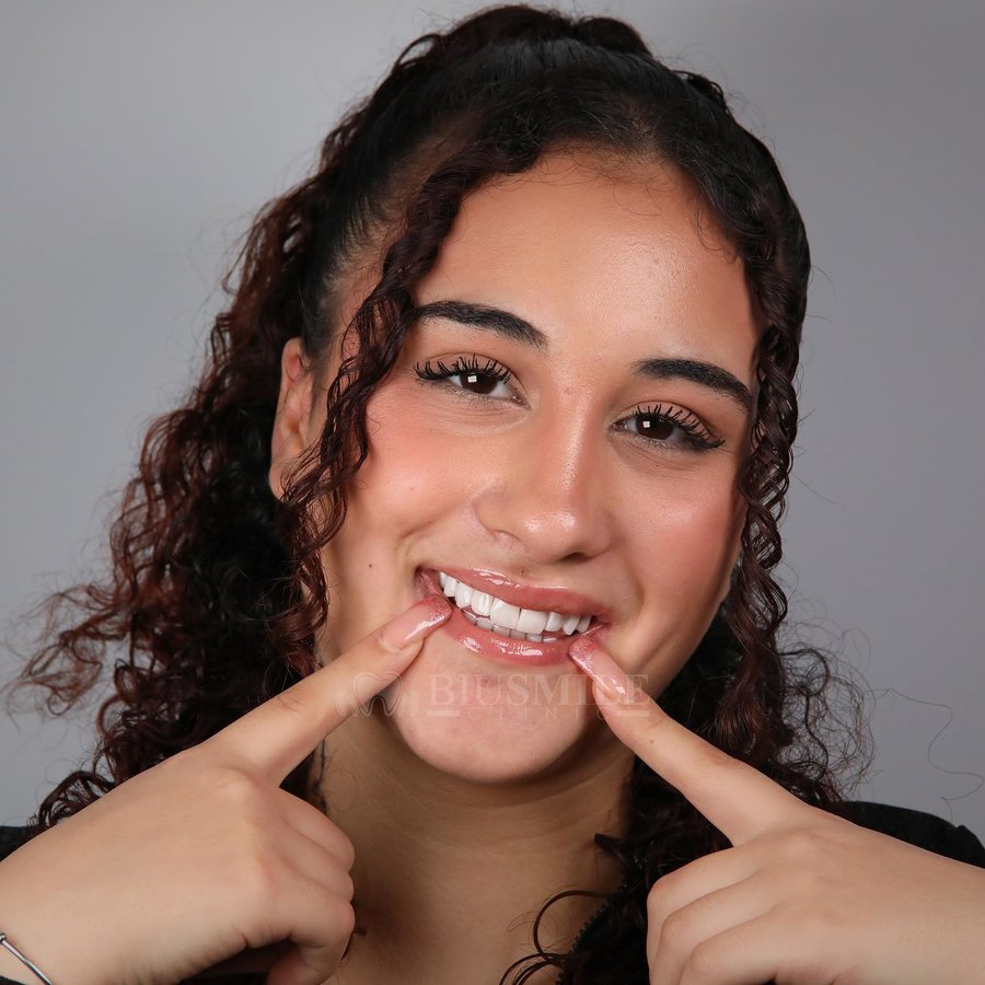 عيادة الابتسامة بيو - Biu smile clinic