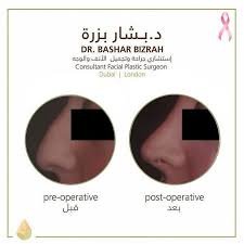 مركز بزرة الطبي - Bizrah Medical Centre