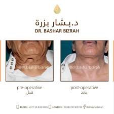 مركز بزرة الطبي - Bizrah Medical Centre