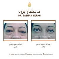 مركز بزرة الطبي - Bizrah Medical Centre