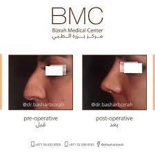 مركز بزرة الطبي - Bizrah Medical Centre