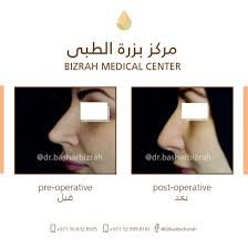 مركز بزرة الطبي - Bizrah Medical Centre