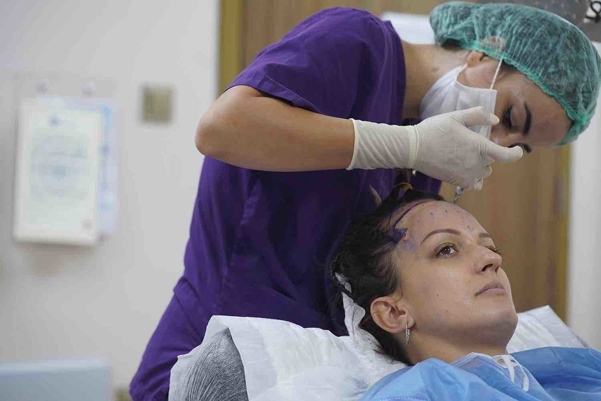 Blue Magic Group - Hair Transplant Professionals - Blue Magic Group - Hair Transplant Professionals