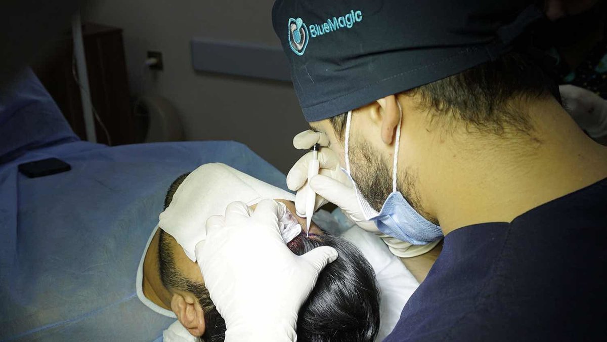 Blue Magic Group - Hair Transplant Professionals - Blue Magic Group - Hair Transplant Professionals