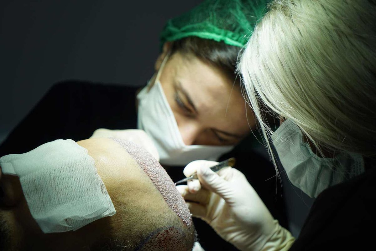 Blue Magic Group - Hair Transplant Professionals - Blue Magic Group - Hair Transplant Professionals