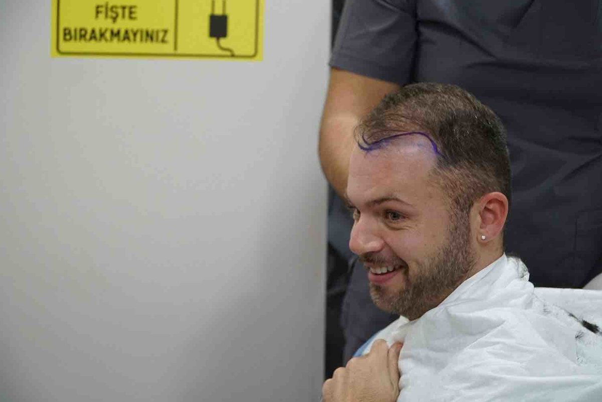 Blue Magic Group - Hair Transplant Professionals - Blue Magic Group - Hair Transplant Professionals