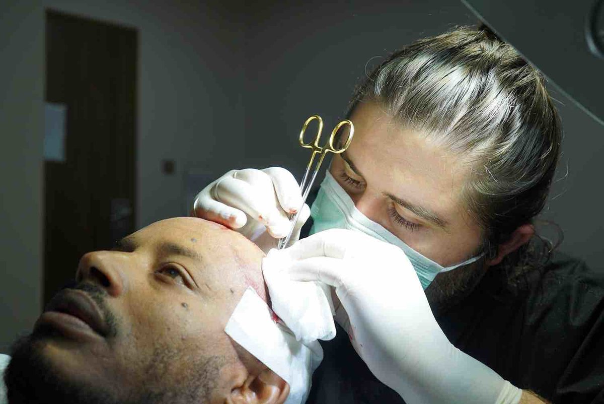 Blue Magic Group - Hair Transplant Professionals - Blue Magic Group - Hair Transplant Professionals