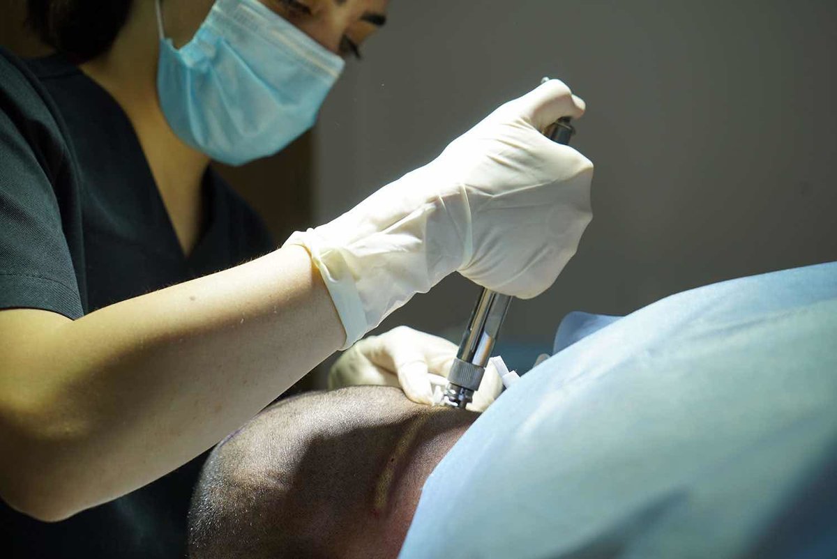 Blue Magic Group - Hair Transplant Professionals - Blue Magic Group - Hair Transplant Professionals