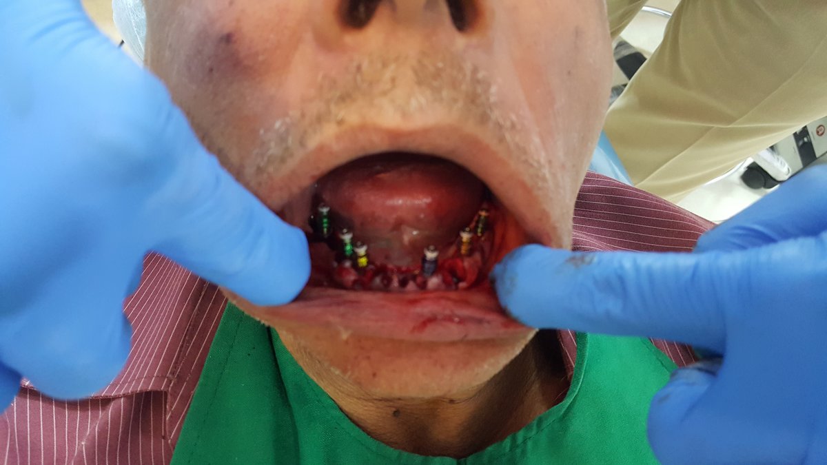 Blue Sky Dental Care - Blue Sky Dental Care