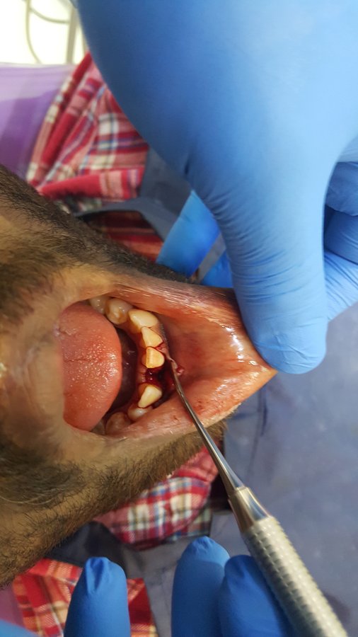 Blue Sky Dental Care - Blue Sky Dental Care