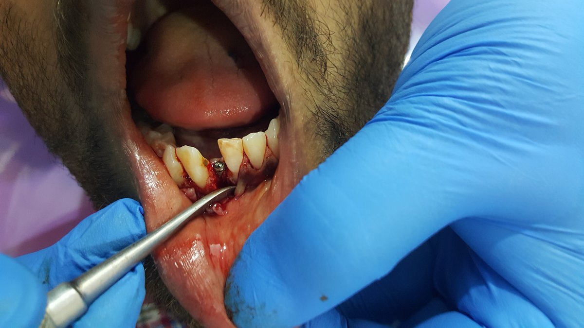 Blue Sky Dental Care - Blue Sky Dental Care