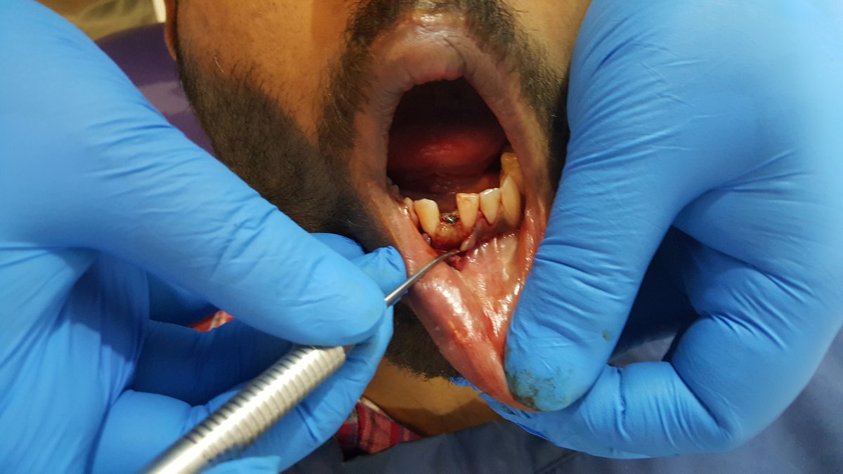 Blue Sky Dental Care - Blue Sky Dental Care