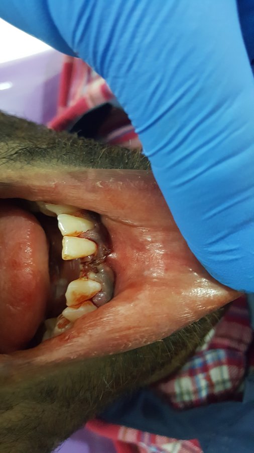 Blue Sky Dental Care - Blue Sky Dental Care