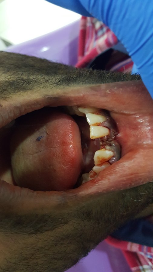 Blue Sky Dental Care - Blue Sky Dental Care