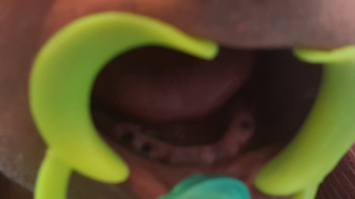 Blue Sky Dental Care - Blue Sky Dental Care