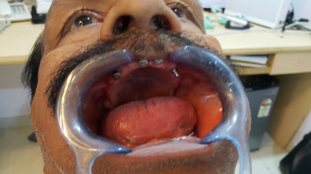 Blue Sky Dental Care - Blue Sky Dental Care