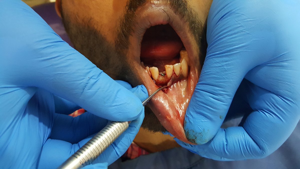 Blue Sky Dental Care - Blue Sky Dental Care