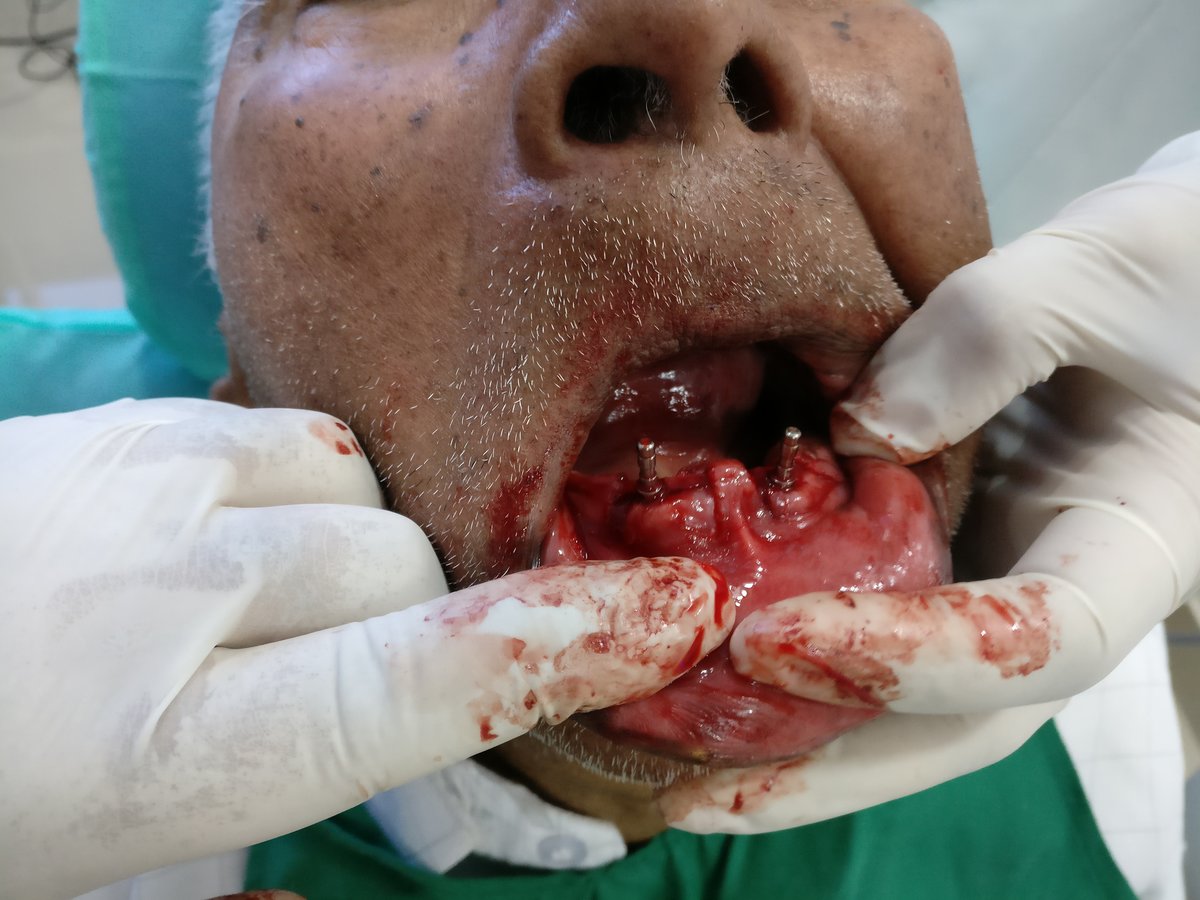 Blue Sky Dental Care - Blue Sky Dental Care