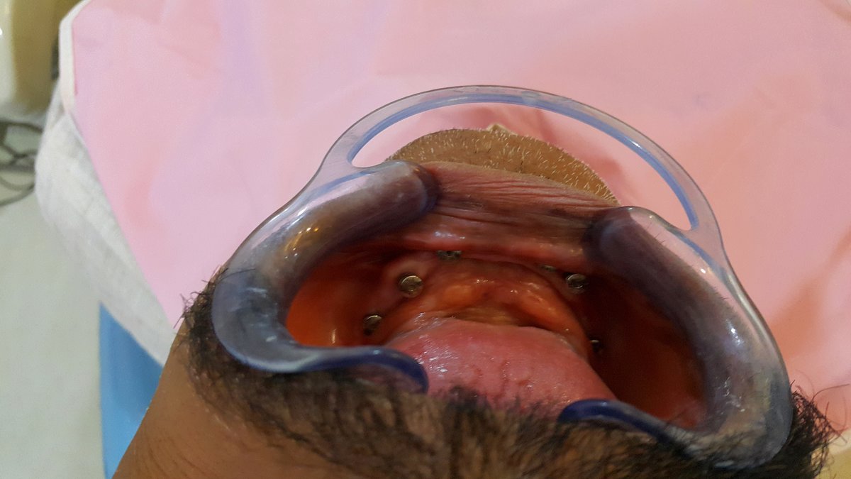 Blue Sky Dental Care - Blue Sky Dental Care