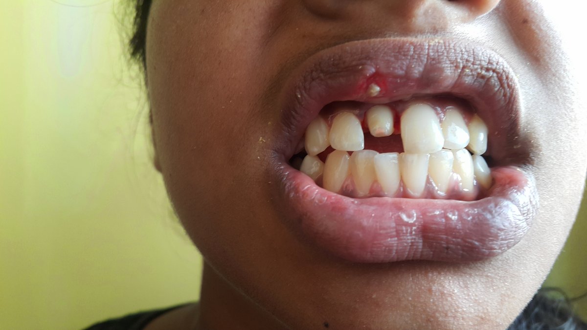 Blue Sky Dental Care - Blue Sky Dental Care