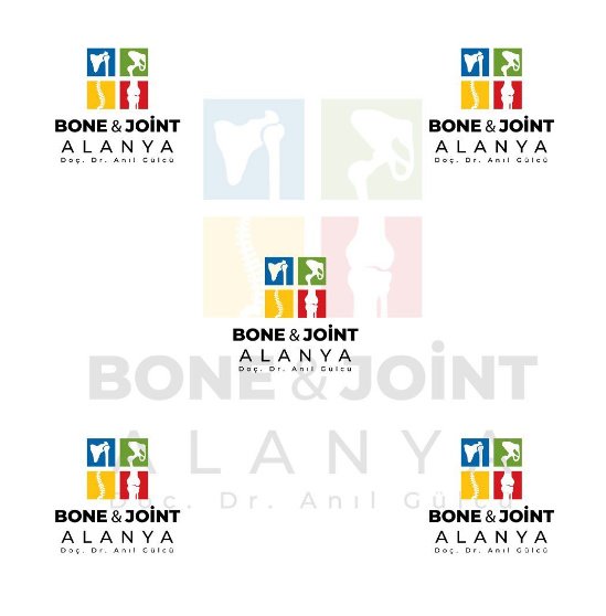 بونجوينتألانيا - BoneJointAlanya